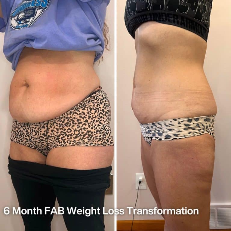 weight loss transformation