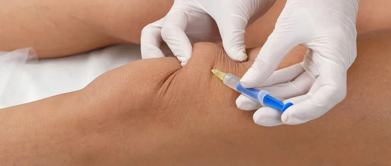 Knee injection